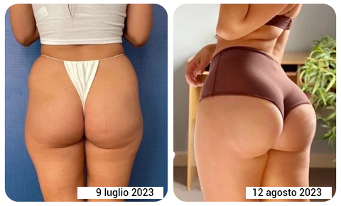 Olio liftante per glutei e torace!